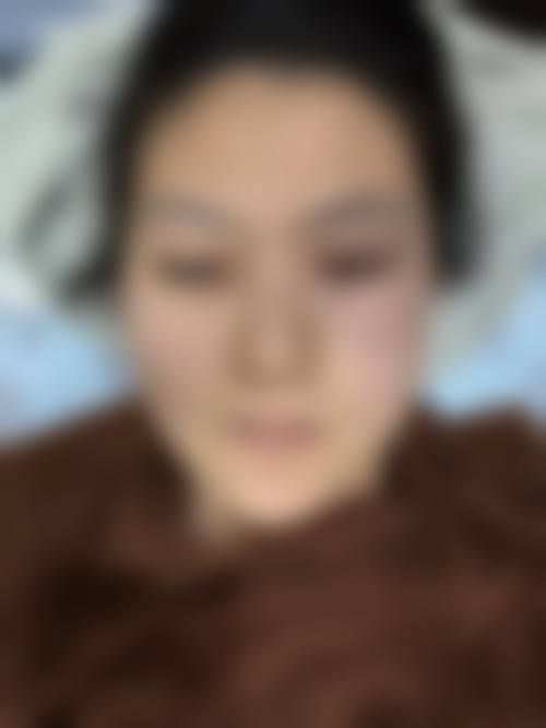 部分医院设备价格