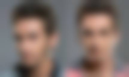 韩国SY整形外科真人口碑评价怎么样？