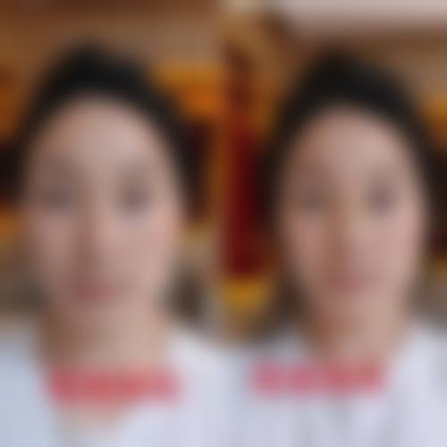 其他天津非凡双眼皮医生