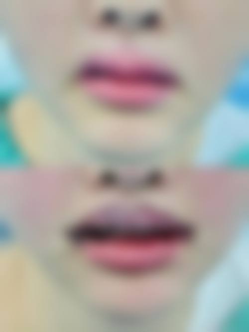 贵阳云岩纤乐儿医疗美容诊所真人口碑评价怎么样？