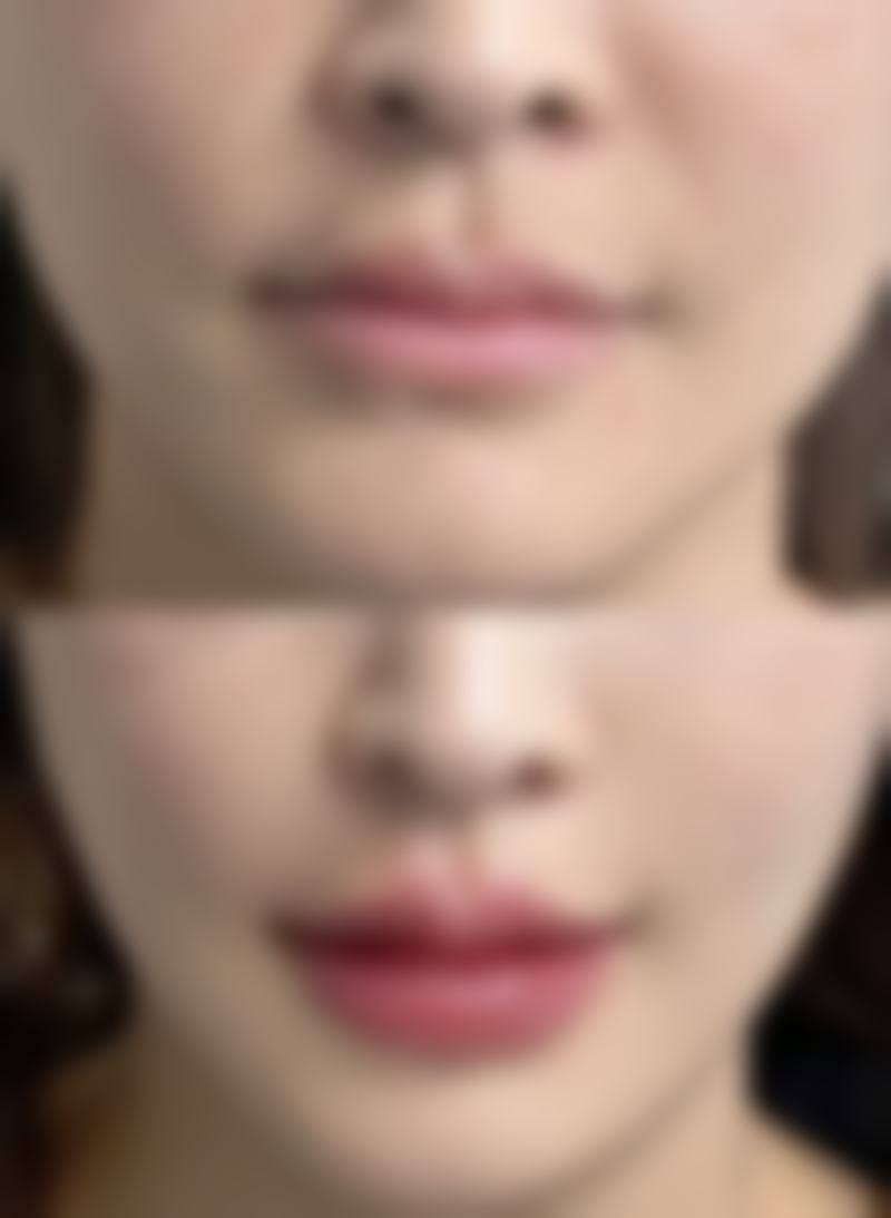 新昌素美医疗美容诊所真人口碑评价怎么样?