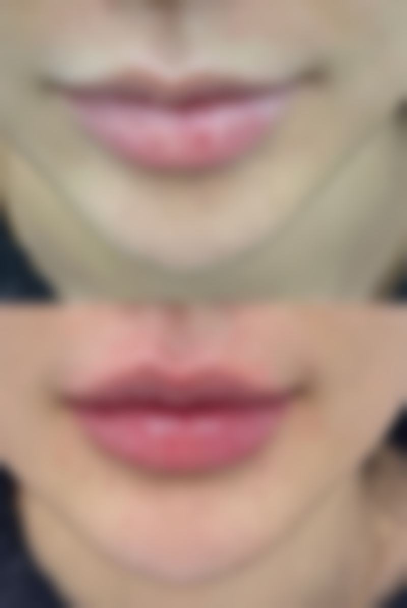 大连阎玲玉抗衰医疗整形医院详细的预约挂号方式及流程