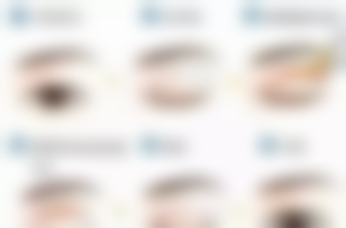 不同情况下假体是否需要取出的判断