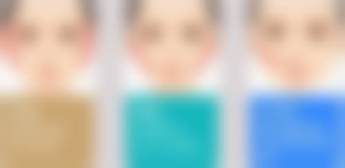 泡泡眼可选的双眼皮手术方式大盘点