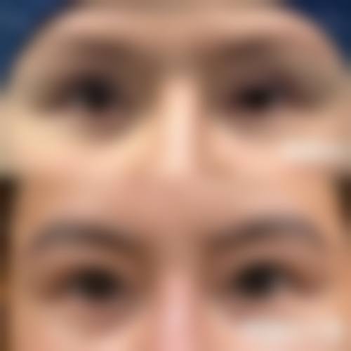 聂丽丽医生擅长项目