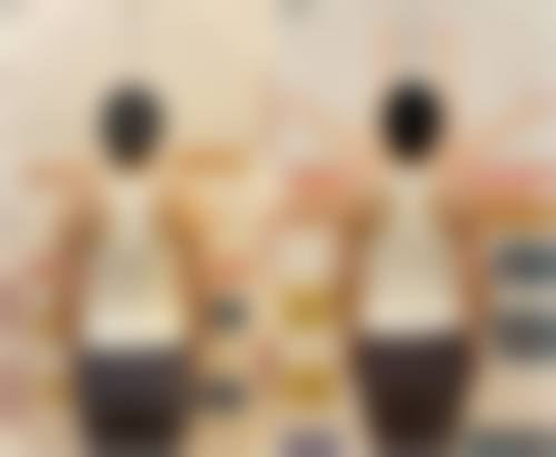 惠州市惠城区梦臻医疗美容门诊部收费价格表/收费标准