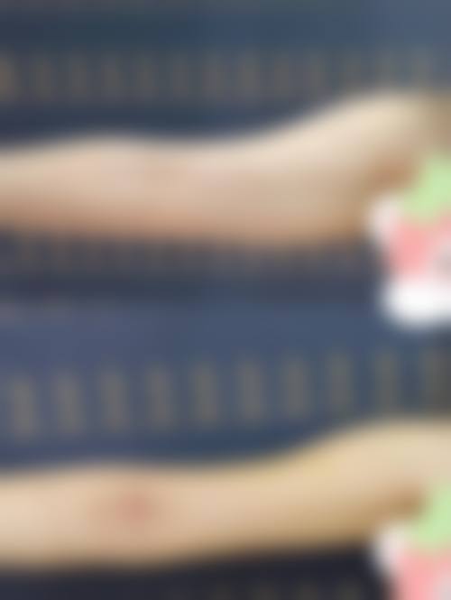 王旭冰医生技术优势