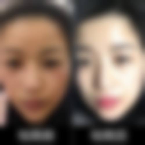 济南海峡整形医院靠谱吗？专家团队技术精湛，特色项目成效显著，口碑获广泛赞誉！ 