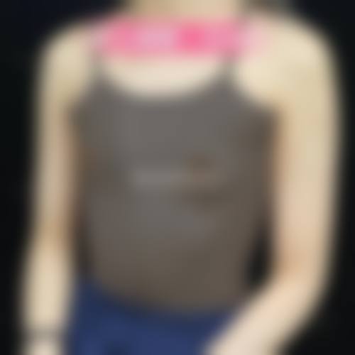 陈柳义医生口碑评价及真人实例