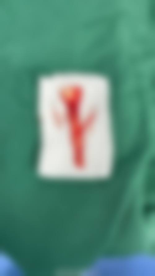 沈阳浑南医莱美整形医院收费价格表/收费标准