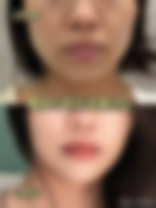 泉州丰泽脂管加医疗美容特色项目及技术优势