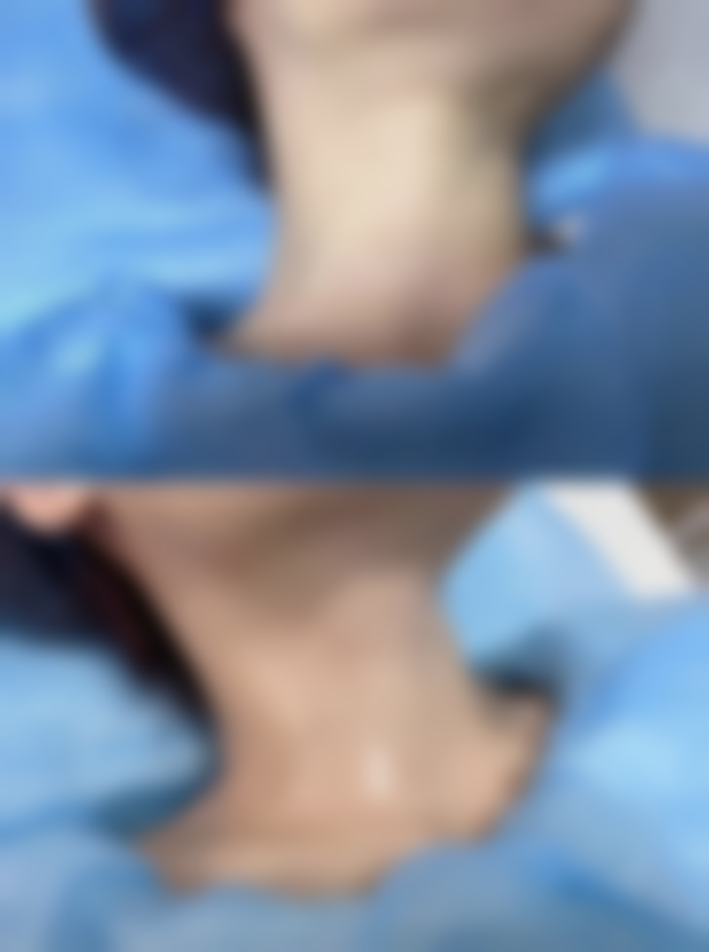 吉适：英国进口的舒适效率高瘦脸之选