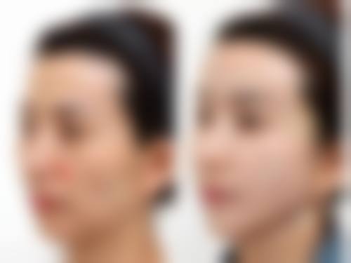 杨玉兰医生口碑评价及真人实例