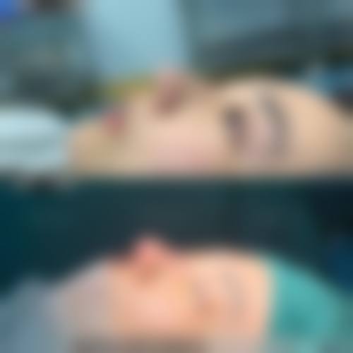 海薇打鼻子的优势