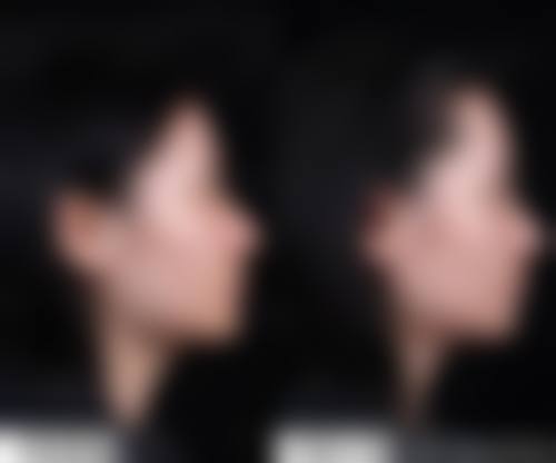 皮秒激光祛斑优质医院