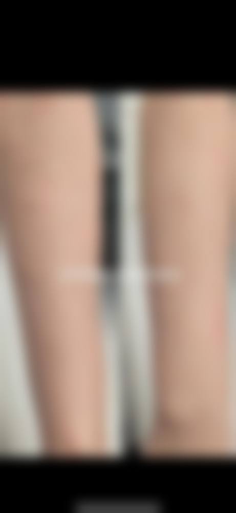 台州椒江睿仕医疗美容门诊部真人口碑评价怎么样？