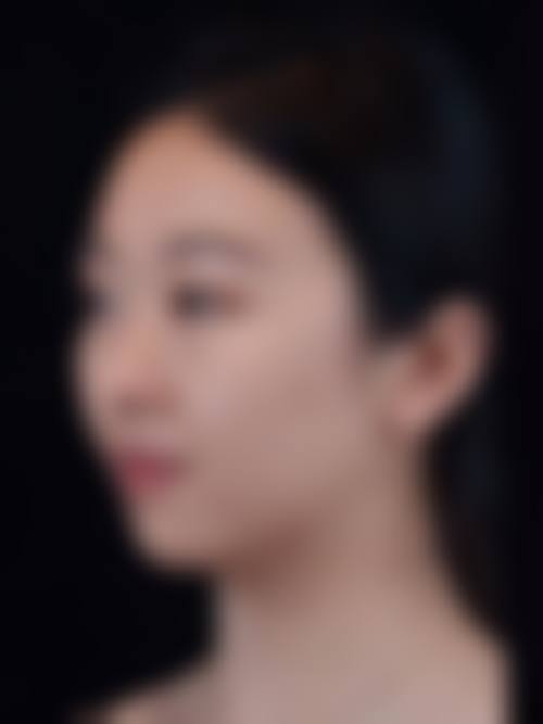 北京东田丽格整形医疗美容真人口碑评价怎么样?