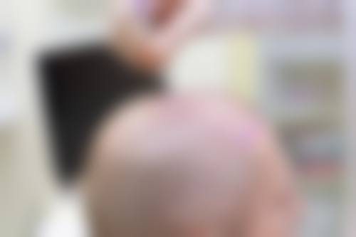 部分整形项目价格参考