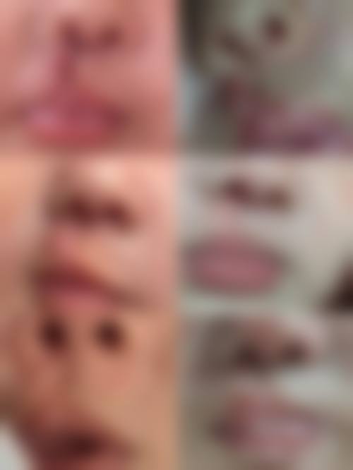 蚌埠医学校第一附属医院整形烧伤科收费价格表/收费标准