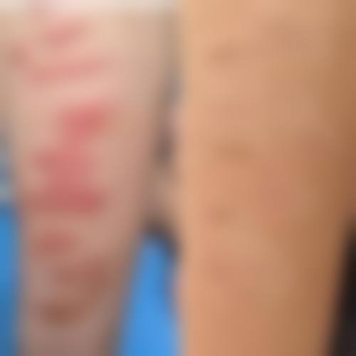 连云港亿大整形医院收费价格表/收费标准