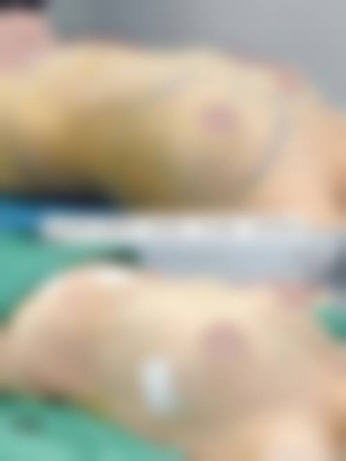 术后成效与患者反馈