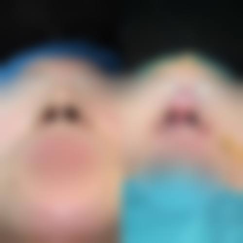 姜敏医生技术优势