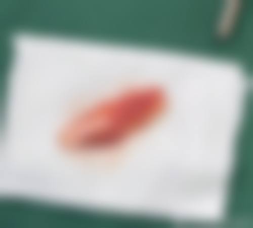 蚌埠医学校第一附属医院整形烧伤科特色项目及技术优势