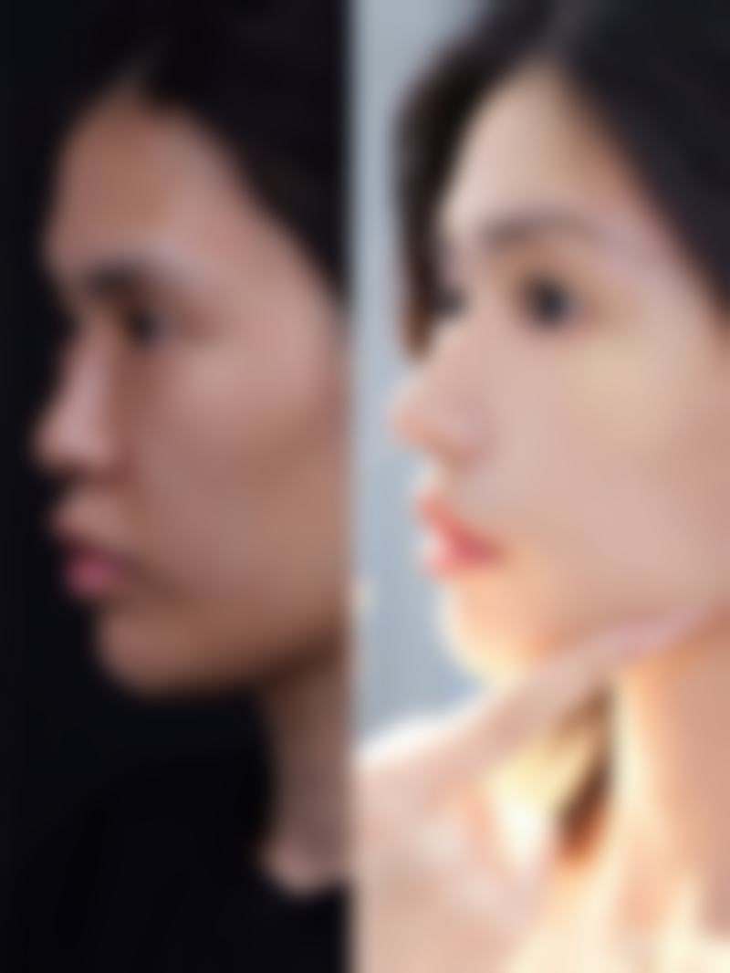 价格与价值分析