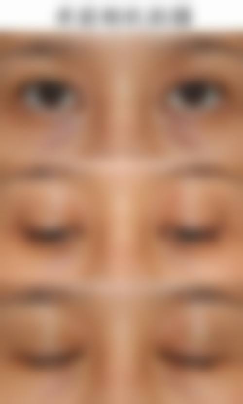 宁波海曙壹壹医疗美容（轻医美）真人口碑评价怎么样？