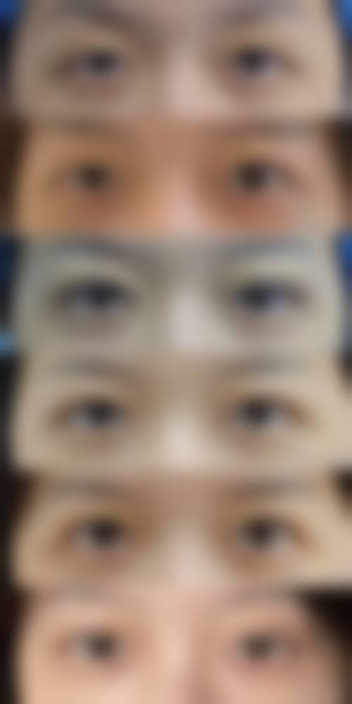 于晓雪医生技术优势