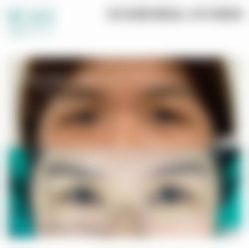 双眼皮做的好的医生有哪些？如深圳富华田芳斌、李俊，术后效果好还享完善诊疗服务！ 