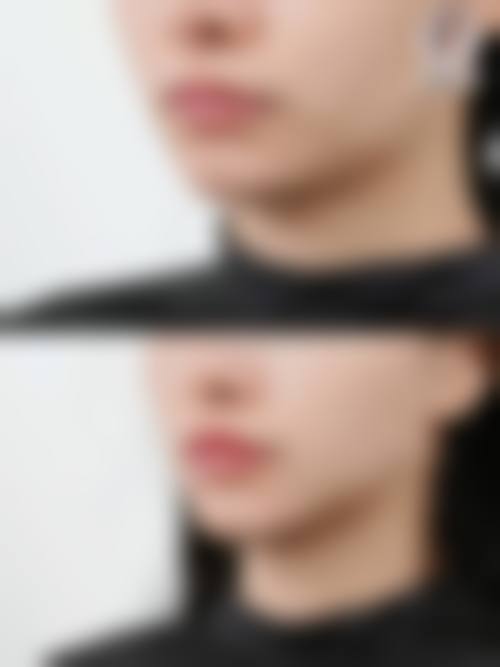 枣阳爱尚汉辰整形医院真人口碑评价怎么样？