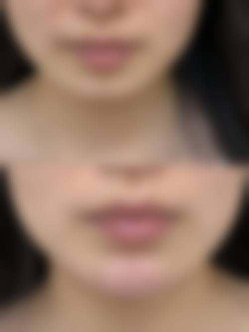 reberry皮肤科真人口碑评价怎么样？