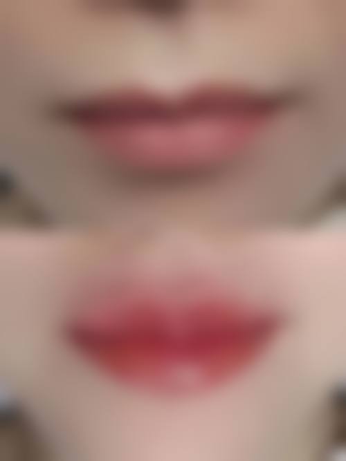 陶洪文医生口碑评价及真人实例