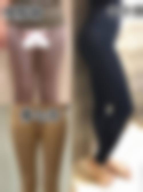 东莞美熙伊美医疗美容医院真人口碑评价怎么样？