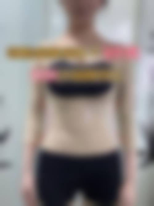 合肥大韩医疗整形美容门诊部真人口碑评价怎么样？