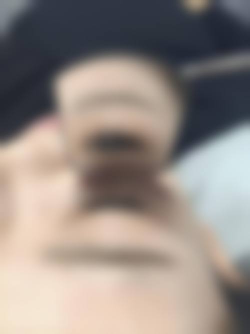 杭州新生植发医院排名｜全国连锁口碑佳，TDDP体系养护优，价格透明合理！ 