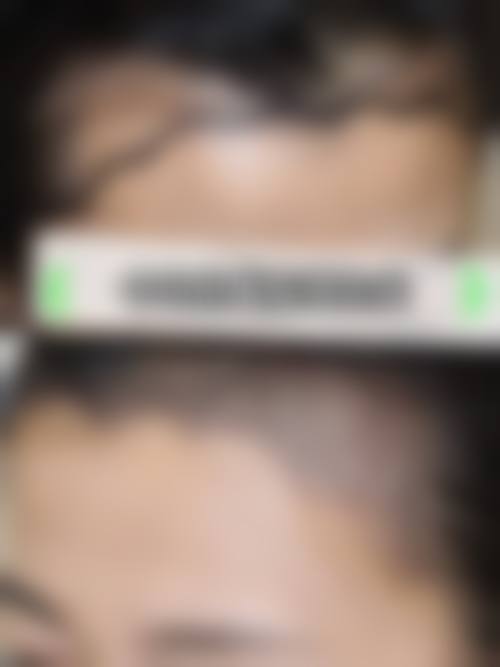 天津熙朵丽尊医疗美容医院详细的预约挂号方式及流程