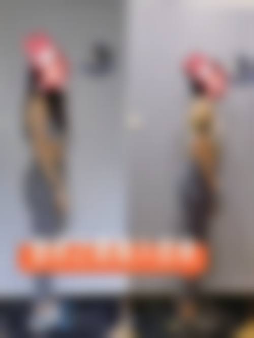 晋中美丽韩整形美容门诊详细的预约挂号方式及流程