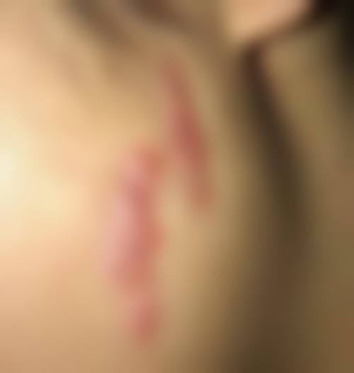 深圳曹孟君医疗美容