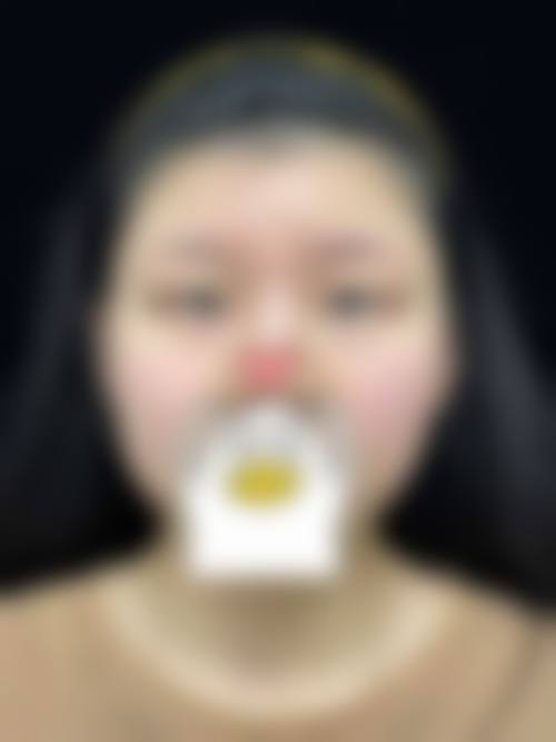 晋中兰积整形医院特色项目及技术优势