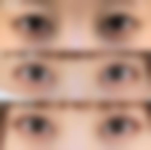 南昌瑞熙医疗美容医院真人口碑评价怎么样?