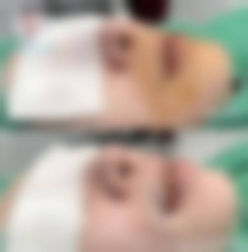 天津熙朵丽尊医疗美容医院真人口碑评价怎么样？