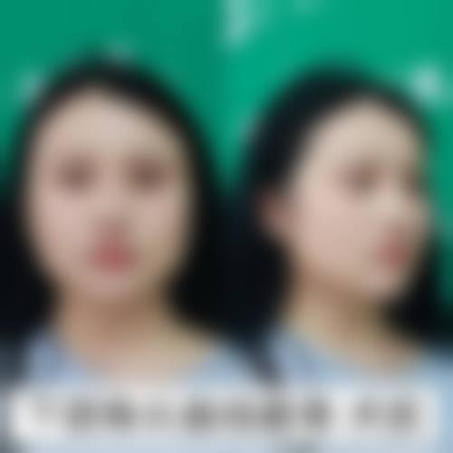 天津VIV护肤美发纹绣微整形医院收费价格表/收费标准