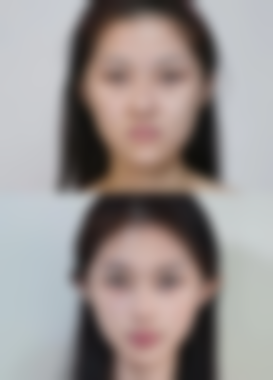 舒适麻醉准备阶段