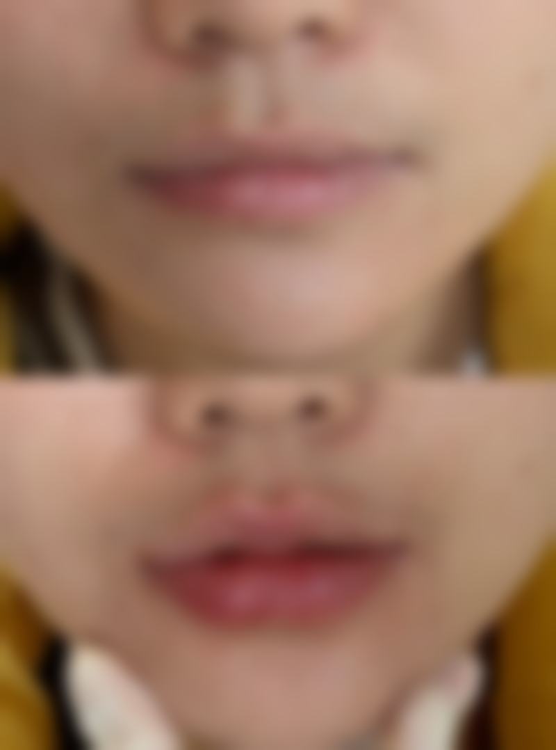 昆明美梵医疗美容诊所收费价格表/收费标准