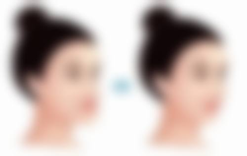 收费优势与就诊攻略