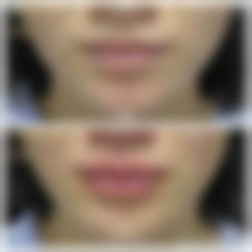 合肥韩美整形医院亮点