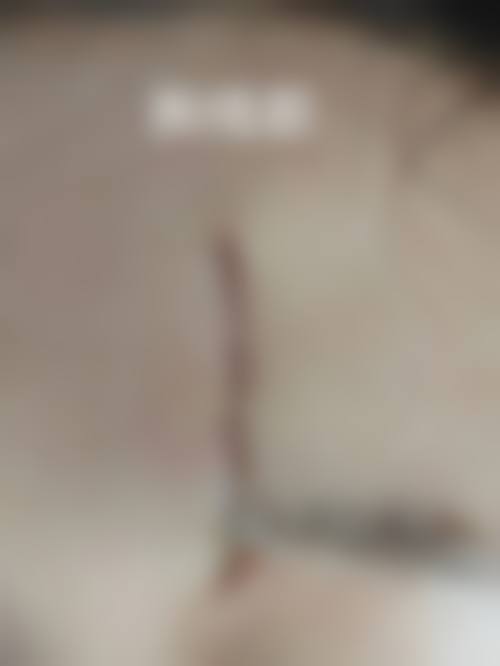 华美医院修复优势