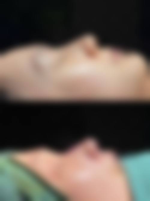 隆鼻价格影响因素